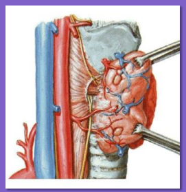 hipocalcemia