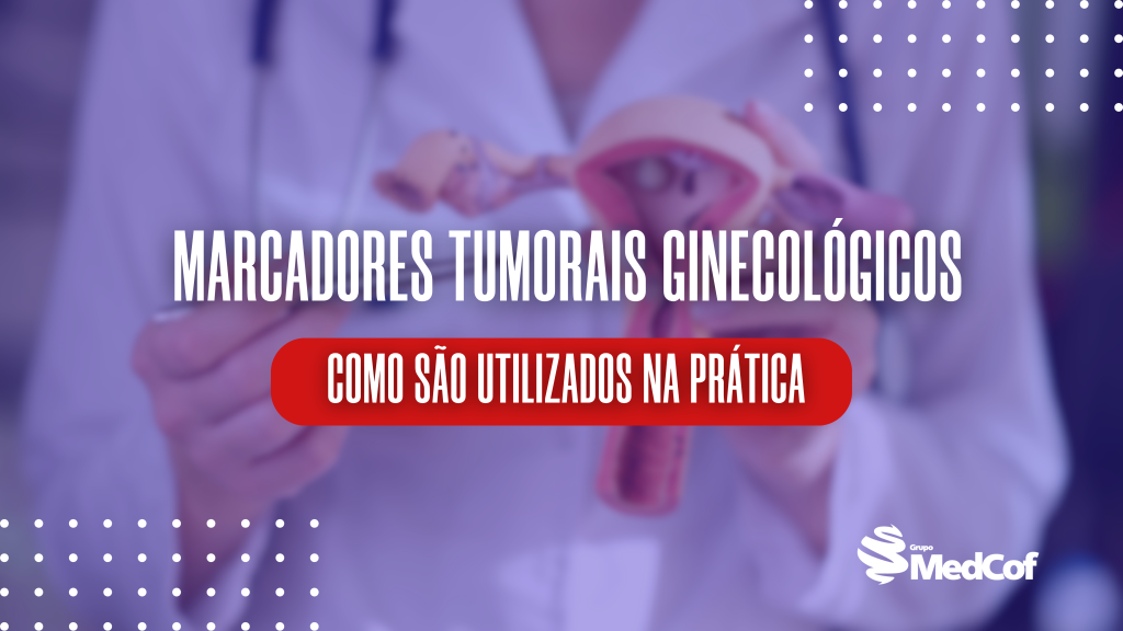 marcador tumoral, marcadores tumorais, marcadores tumorais ginecológicos, tumores ginceológicos, câncer ovário, cancer de ovario, cancer no ovario
