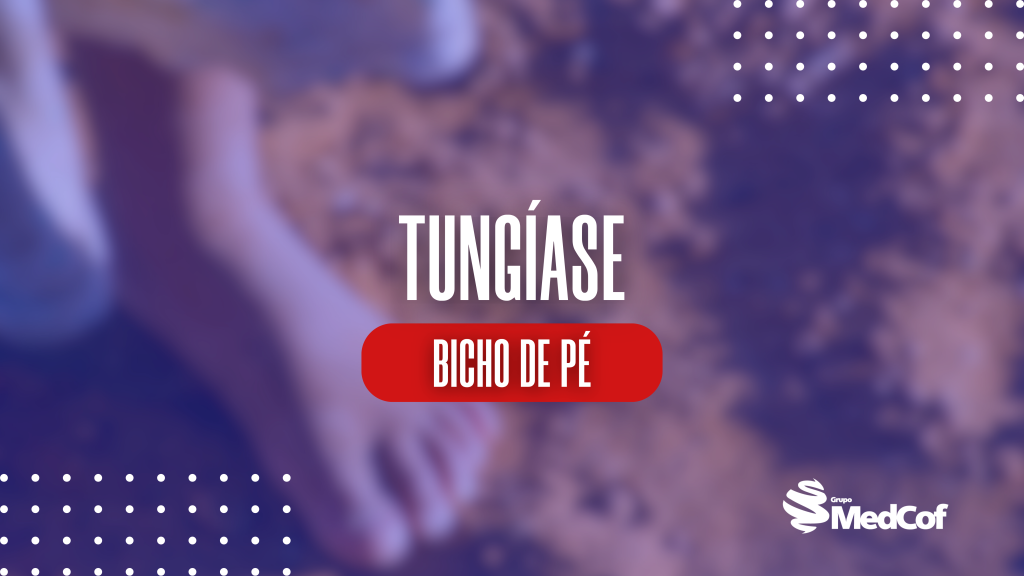 Tungíase, bicho de pé, como tirar bicho de pé, tungiase o que é, tungíase tratamento, tungíase sintomas, tungiase tratamento