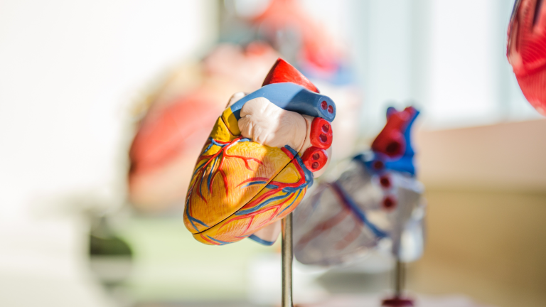 insuficiência aórtica, dissecção aortica, dissecacao aortica, disseccao aortica, dissecção da aorta causas, dissecção de aorta sintomas