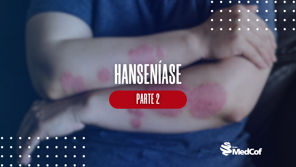 hanseníase fotos, hanseníase, clínica hanseníase