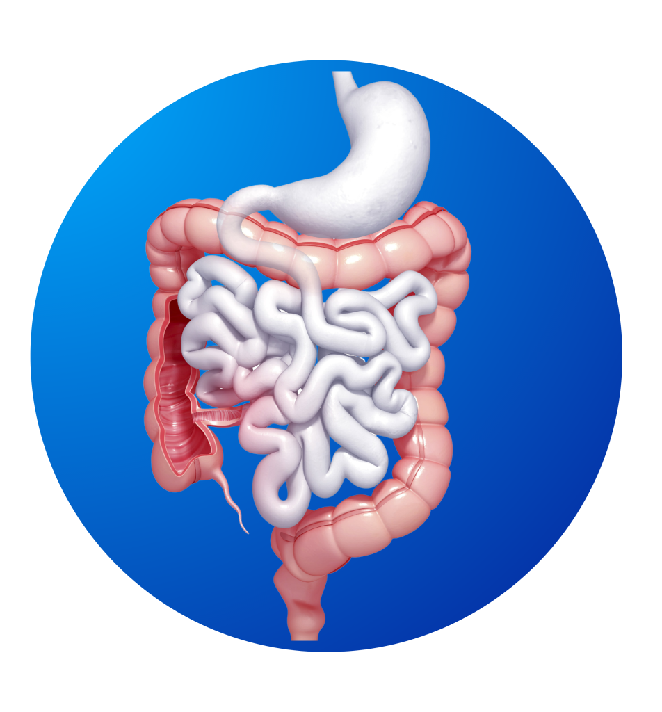 Retocolite Ulcerativa, recolite ulcerativa, RCU, retocolite ulcerativa sintomas, retocolite ulcerativa tratamento, sintomas de retocolite ulcerativa, retocolite ulcerativa complicações