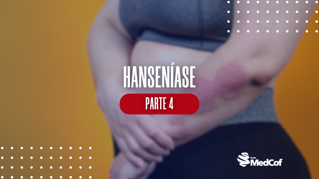 hanseniase diagnostico, hanseniase tratamento, hanseníase tratamento, hanseníase diagnóstico, diagnóstico da hanseníase, como é feito o diagnóstico da hanseníase, diagnóstico hanseníase, exame para diagnóstico de hanseníase, tratamento da hanseníase, tratamento para hanseníase, tratamento hanseníase, hanseníase