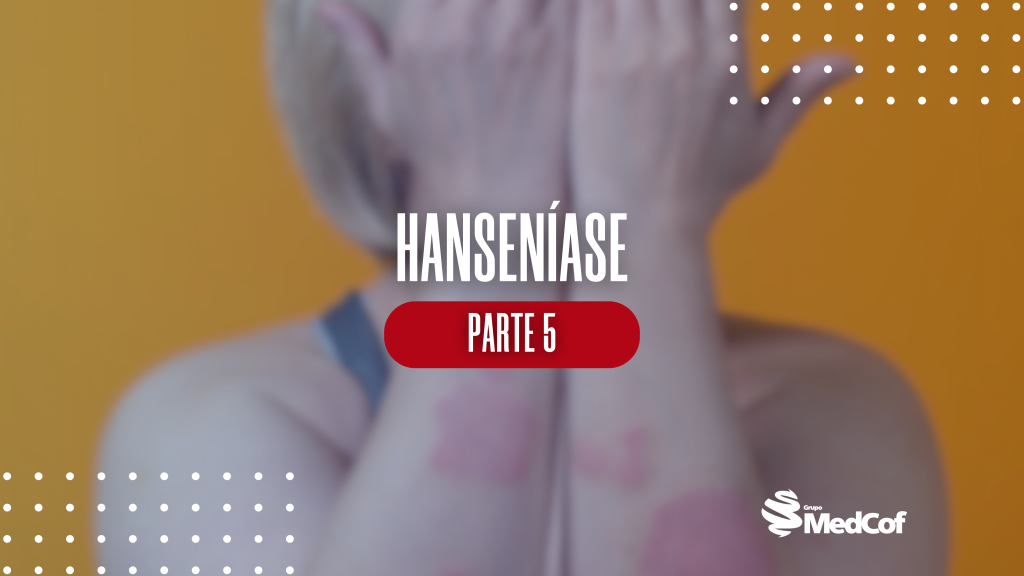 vigilancia epidemiológica da hanseniase, vigilância epidemiológica da hanseníase, hanseniase diagnostico, hanseniase tratamento, hanseníase tratamento, hanseníase diagnóstico, diagnóstico da hanseníase, como é feito o diagnóstico da hanseníase, diagnóstico hanseníase, exame para diagnóstico de hanseníase, tratamento da hanseníase, tratamento para hanseníase, tratamento hanseníase, hanseníase