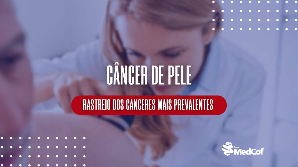 abcde, diretrizes cancer de pele sociedade brasileira de dermatologia, diretrizes câncer de pele sociedade brasileira de dermatologia, sociedade brasileira de dermatologia cancer de pele, sociedade brasileira de dermatologia câncer de pele, cancer de pele sociedade brasileira de dermatologia, câncer de pele sociedade brasileira de dermatologia, cancer de pele abcd, câncer de pele abcd, câncer basocelular, cancer basocelular, câncer espinocelular, cancer espinocelular, regra abcde cancer de pele, regra abcde câncer de pele, regra do abcde cancer de pele, regra do abcde câncer de pele, abcde cancer de pele, abcde câncer de pele, abcde do cancer de pele, abcde do câncer de pele, abcd cancer de pele, abcd câncer de pele, rastreamento de câncer de pele, rastreamento de cancer de pele, quem pode fazer o rastreamento para o câncer de pele, quem pode fazer o rastreamento para o cancer de pele, rastreio cancer de pele, rastreio câncer de pele, rastreio do cancer de pele, rastreio do câncer de pele, rastreio de cancer de pele, rastreio de câncer de pele