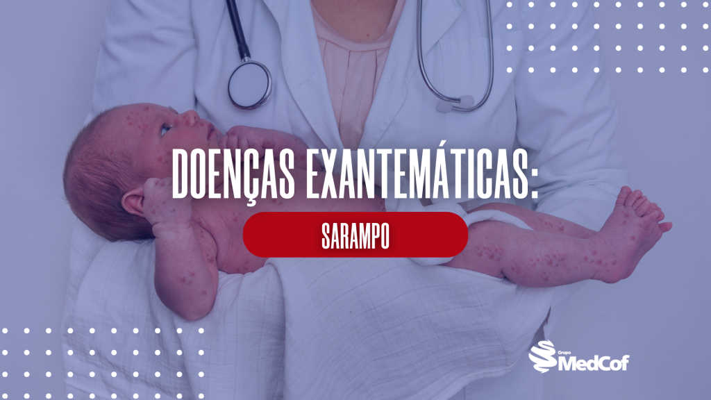 sarampo, sarampo sintomas, sintomas de sarampo, manchas de koplik, vírus do sarampo, doenças exantematicas, exantema