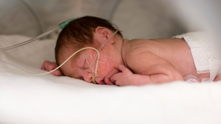 apneia em bebe, apneia neonatal, o que é apneia em bebê prematuro, apneia recem nascido, apneia da prematuridade sintomas, o que é apneia da prematuridade, apneia em prematuro, apneia em recem nascido
