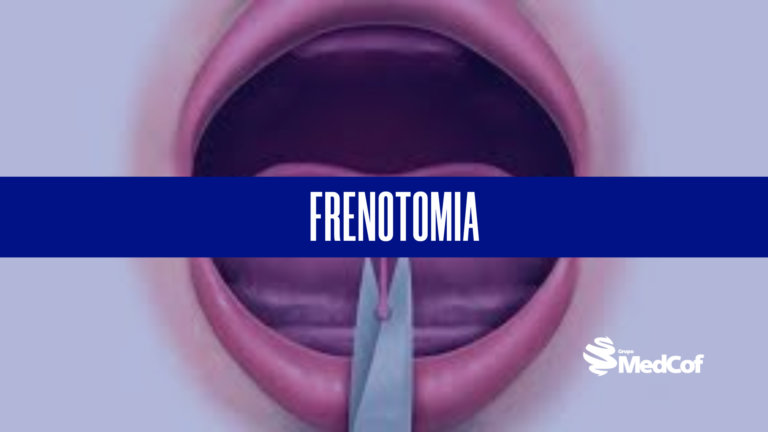 frenotonia