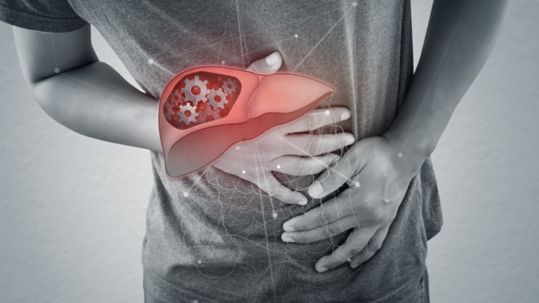Síndrome de Budd-Chiari: Compreendendo o diagnóstico, classificação e tratamento