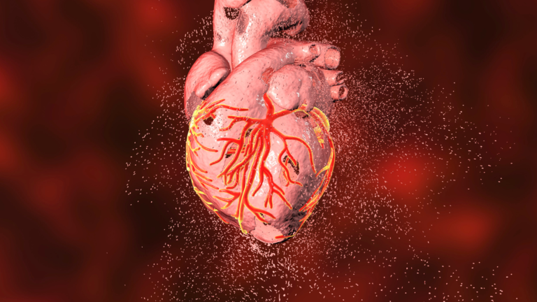 Tetralogia de fallot