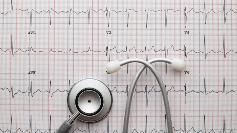 Tudo sobre: Eletrocardiograma