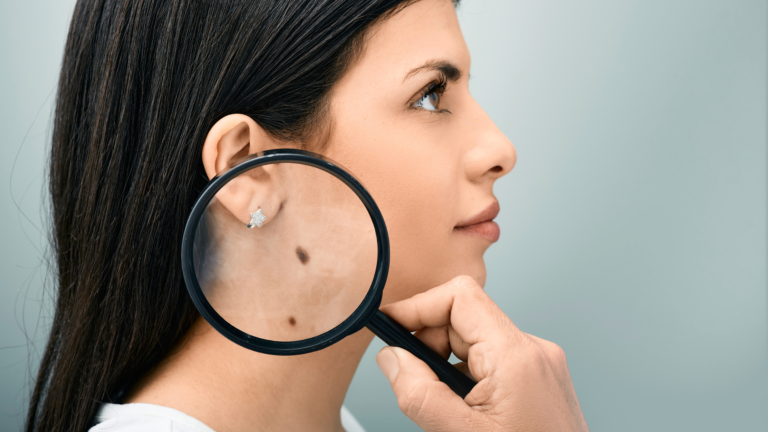 Melanomas e Carcinomas: Avanços e Estratégias para Residentes Médicos