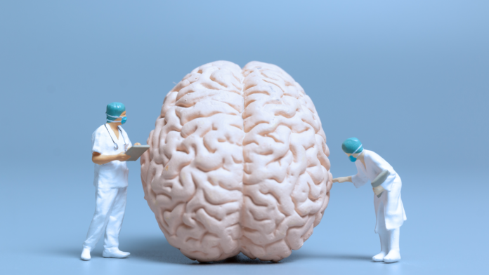 Médicos em miniatura analisando um cérebro.