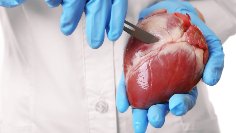 Curiosidades Sobre o Transplante Cardíaco