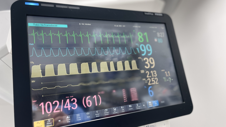 Curiosidades sobre Pós-operatório da Cirurgia Cardíaca