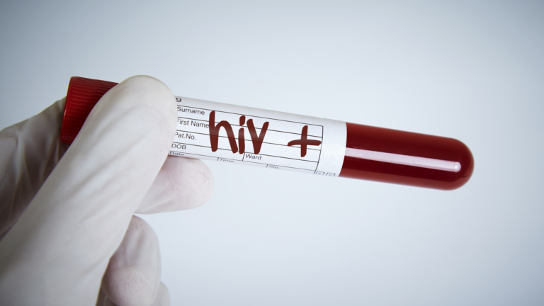 Seis pacientes testam positivo para HIV após transplante de órgãos no RJ