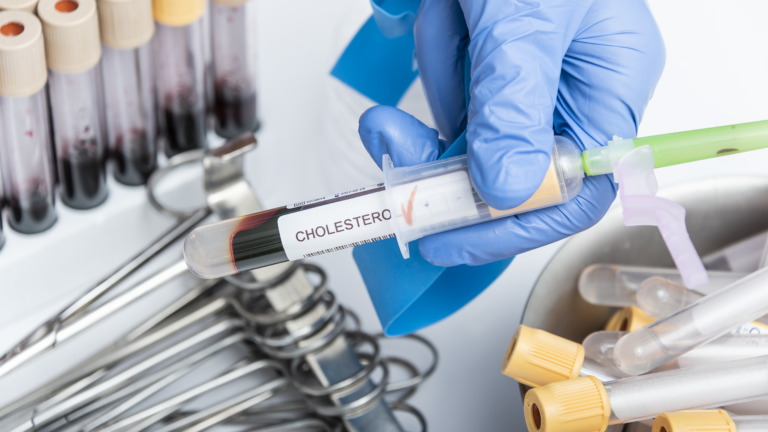 Diagnóstico de Dislipidemia: Classificação e Tratamento do paciente
