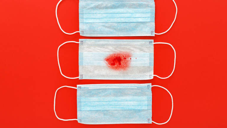 Identificação da Hemoptise na Clínica Médica 