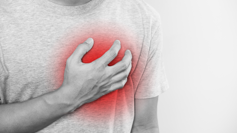 Colchicina e Infarto do Miocárdio Agudo