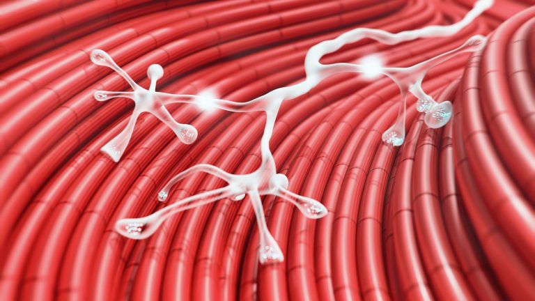 Miastenia Gravis: diagnóstico, tratamento, quadro clínico e mais