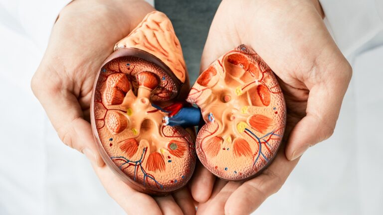 Litíase Renal: a famosa pedra no rim!