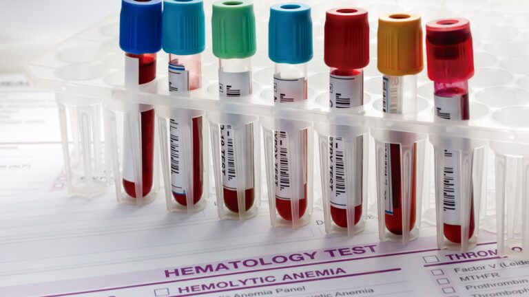 Hematologia clínica, onco e pediátrica: entenda o que são!