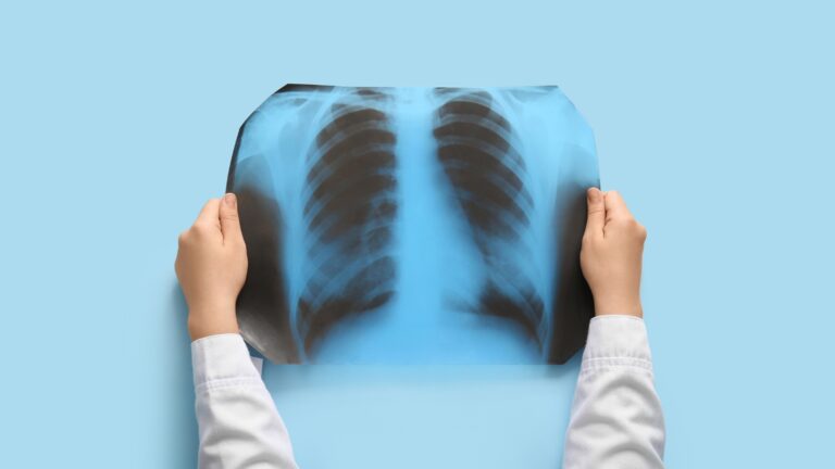 Pneumologia: Entenda o que é, o que faz, residência e remuneração