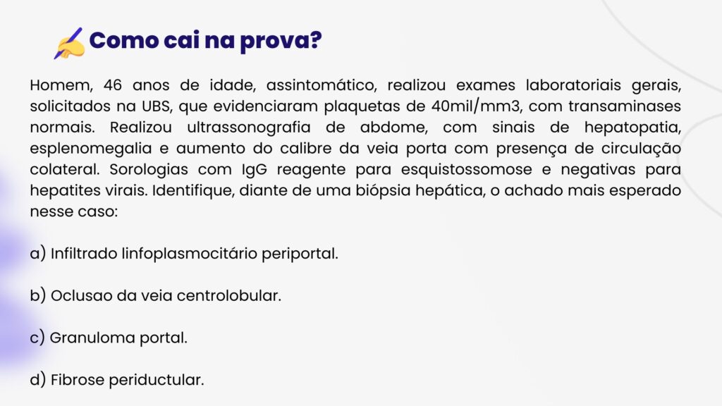 Homem, 46 anos de idade, assintomático, realizou exames laboratoriais gerais, solicitados na UBS, que evidenciaram plaquetas de 40mil/mm3, com transaminases normais. Realizou ultrassonografia de abdome, com sinais de hepatopatia, esplenomegalia e aumento do calibre da veia porta com presença de circulação colateral. Sorologias com IgG reagente para esquistossomose e negativas para hepatites virais. Identifique, diante de uma biópsia hepática, o achado mais esperado nesse caso:

a) Infiltrado linfoplasmocitário periportal.

b) Oclusao da veia centrolobular.

c) Granuloma portal.

d) Fibrose periductular.