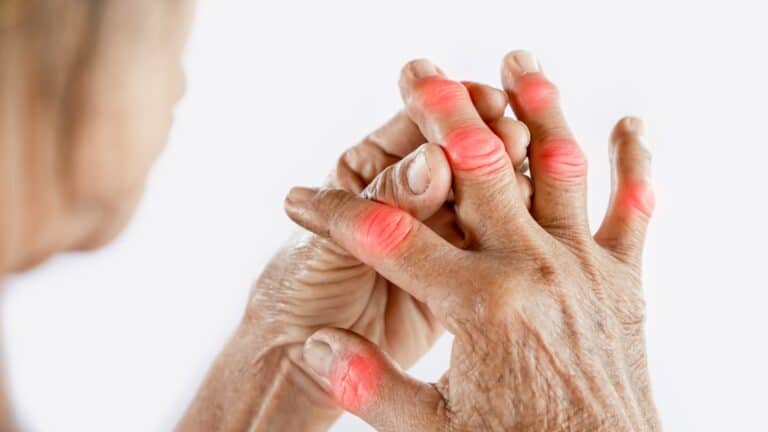 Dor articular: pode ser osteoartrite?