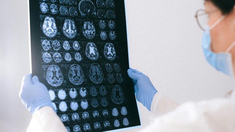 Profissional de saúde com máscara e luvas analisando uma lâmina de ressonância magnética cerebral. O exame mostra diversas seções do cérebro, empregadas no diagnóstico de doenças neurológicas como meningite, tumores cerebrais ou distúrbios neurológicos.