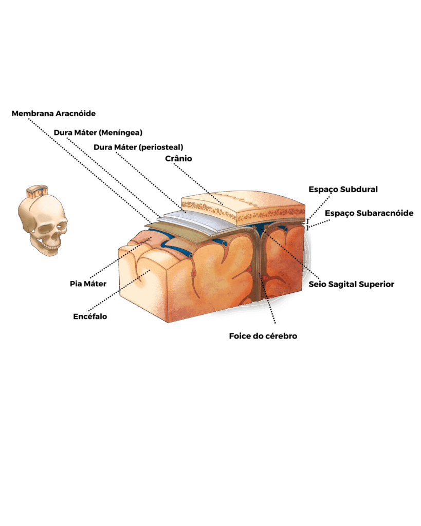 Modelo anatômico das meninges cerebrais em corte transversal mostrando pia-máter, aracnoide, dura-máter (meníngea e periosteal), espaços intracranianos (subdural, subaracnóideo), e a relação com o crânio e o encéfalo. Inclui detalhes como o seio sagital superior (drenagem venosa) e a foice do cérebro (dura-máter separando os hemisférios cerebrais). A imagem é ideal para estudo da anatomia do sistema nervoso central e suas estruturas de proteção.