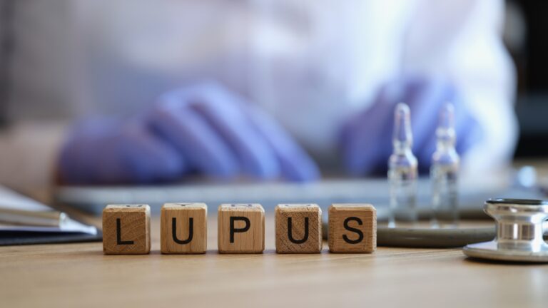 Lúpus eritematoso sistêmico (LES): sintomas, diagnóstico e tratamento