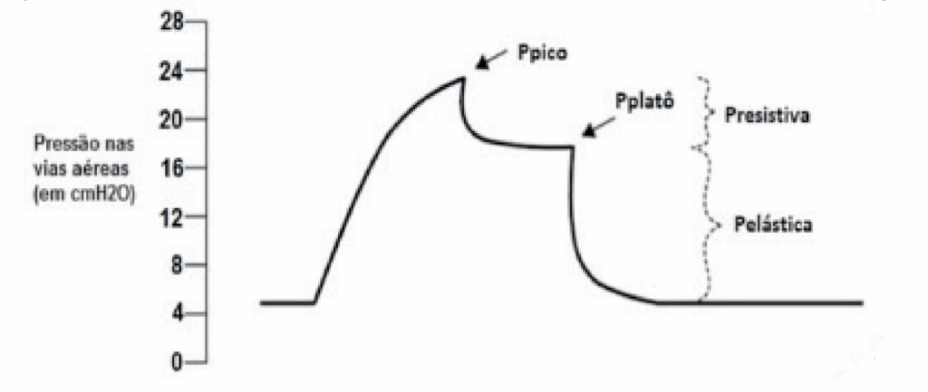 Curva de pressão das vias aéreas na ventilação mecânica, com pressão de pico, platô e componentes resistivos e elásticos