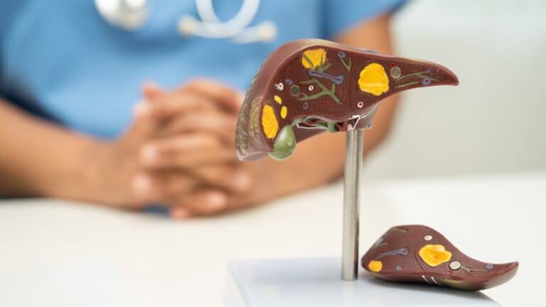 Colelitíase: fisiopatologia, fatores de risco, indicações cirúrgicas e mais!