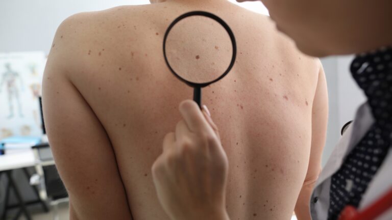 Residência em Dermatologia: duração, salários, rotina e instituições