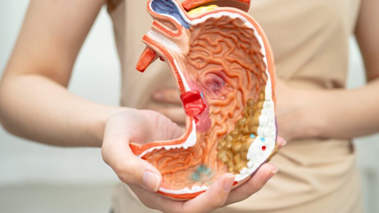 Entenda como funciona e como tratar as principais queixas gástricas