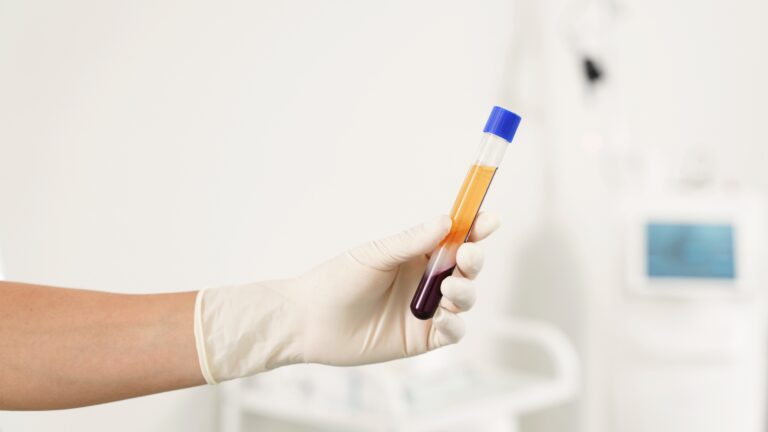 CFM regulamenta uso do plasma rico em plaquetas (PRP): entenda o que muda