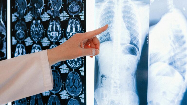 MedCof Radio: preparação estratégica para a prova de título do CBR