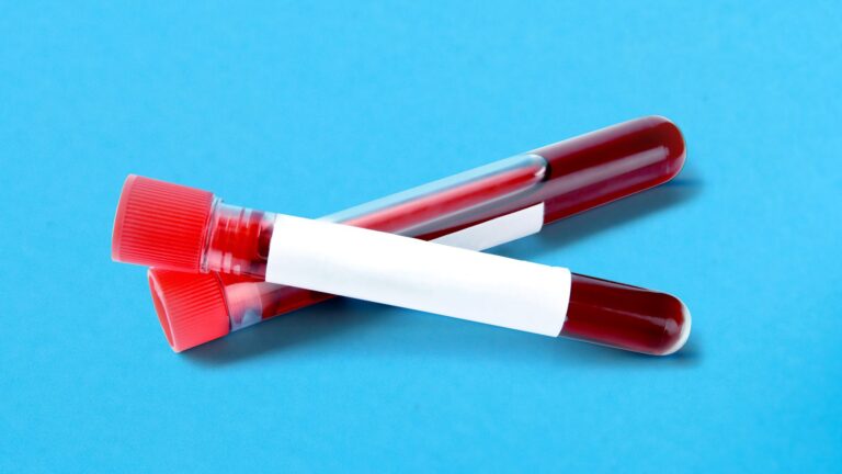 Exame antidoping