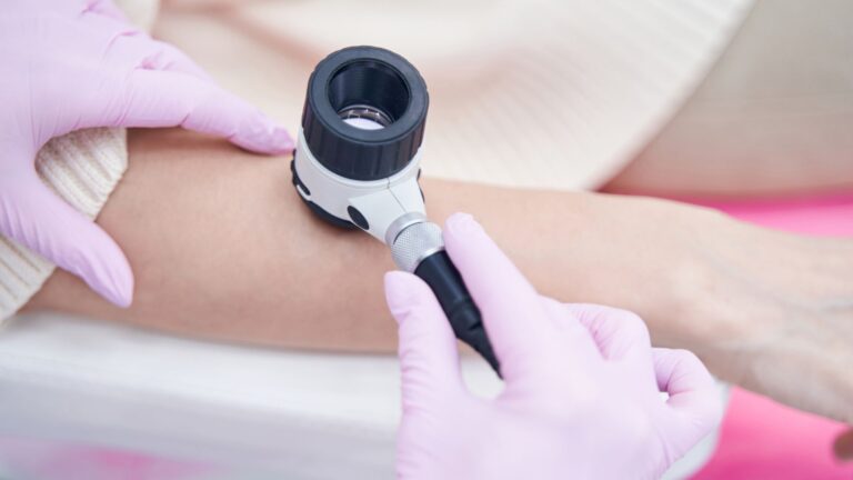 dermatoscopia | Imagem: Pessoa de pele clara, em plano de detalhe (close-up) focado em seu antebraço durante uma avaliação clínica. Uma profissional de saúde, utilizando luvas de procedimento na cor rosa, segura e posiciona um dermatoscópio manual (com corpo nas cores preta, branca e prata) diretamente sobre a pele do paciente para examinar possíveis lesões cutâneas. O paciente veste uma peça de manga longa em tom off-white. O fundo do cenário é neutro, com tons claros e um detalhe em rosa, mantendo-se suavemente desfocado sob uma iluminação limpa e difusa.